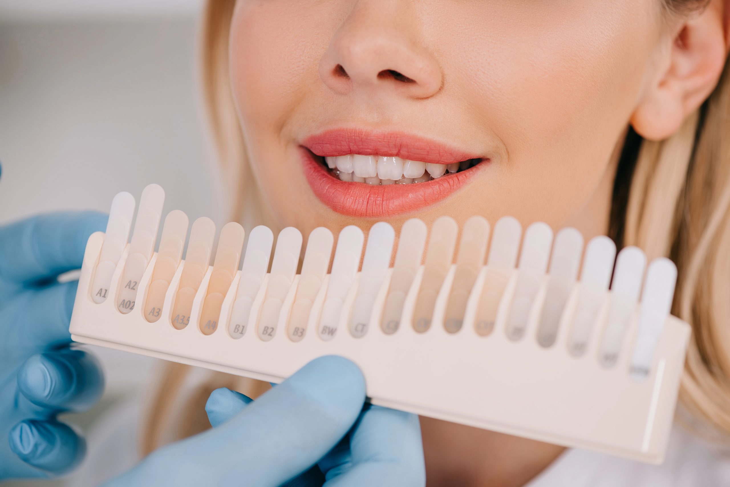 Peekskill Teeth Whitening at Rosen Dental Specialists